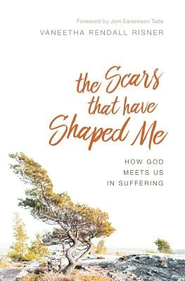 The Scars That Have Shaped Me: How God Meets Us in Suffering Paperback Desiring God