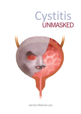 Cystitis Unmasked by Malone-Lee, James