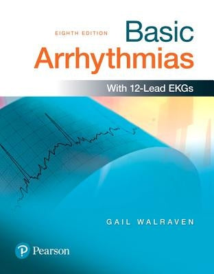 Basic Arrhythmias by Walraven, Gail