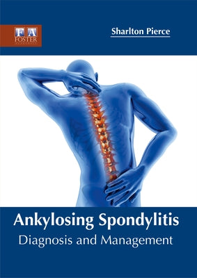 Ankylosing Spondylitis: Diagnosis and Management by Pierce, Sharlton