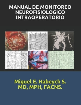 Manual de Monitoreo Neurofisiológico Intraoperatorio. by Habeych S., Mph