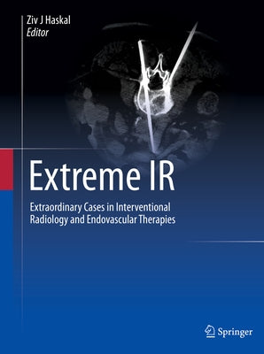 Extreme IR: Extraordinary Cases in Interventional Radiology and Endovascular Therapies by Haskal, Ziv J.