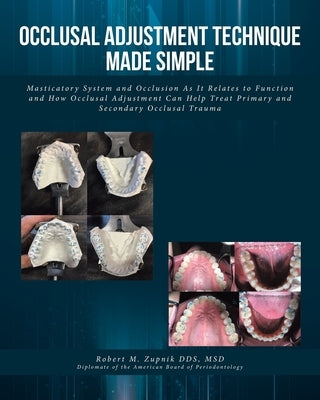 Occlusal Adjustment Technique Made Simple: Masticatory System and Occlusion As It Relates to Function and How Occlusal Adjustment Can Help Treat Prima Paperback Fulton Books