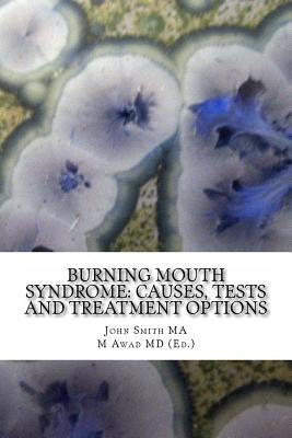 Burning Mouth Syndrome: Causes, Tests and Treatment Options by Awad MD, M.
