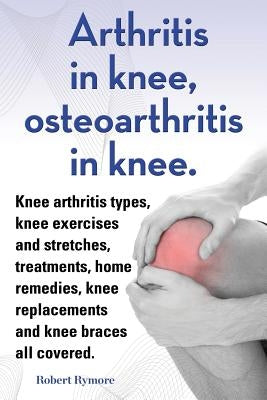 Arthritis in knee, osteoarthritis in knee. Knee arthritis types, knee exercises and stretches, treatments, home remedies, knee replacements and knee b by Rymore, Robert