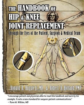 Handbook of Hip & Knee Joint Replacement: Through the Eyes of the Patient, Surgeon & Medical Team Paperback Createspace Independent Publishing Platform
