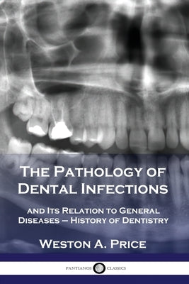 The Pathology of Dental Infections: and Its Relation to General Diseases - History of Dentistry Paperback Pantianos Classics