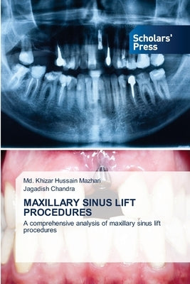 Maxillary Sinus Lift Procedures Paperback Scholars' Press