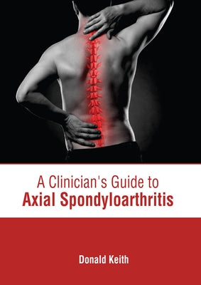 A Clinician's Guide to Axial Spondyloarthritis by Keith, Donald