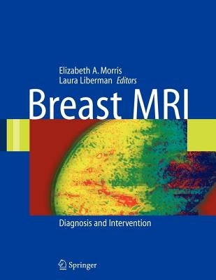 Breast MRI: Diagnosis and Intervention by Liberman, Laura