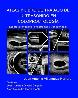 Atlas y Libro de Trabajo de Ultrasonido en Coloproctología by Herrero, Juan a. Villanueva