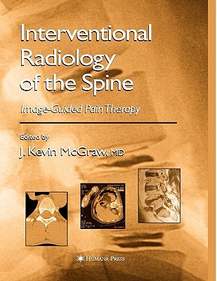 Interventional Radiology of the Spine: Image-Guided Pain Therapy by McGraw, J. Kevin