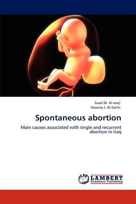 Spontaneous abortion Paperback LAP Lambert Academic Publishing