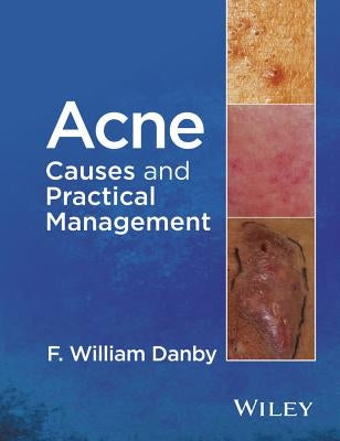 Acne: Causes and Practical Management by Danby, F. William