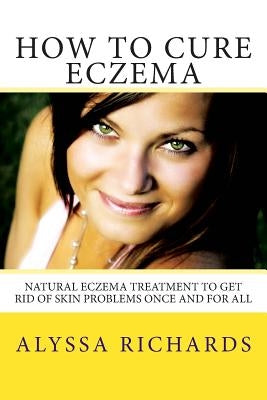 How To Cure Eczema: Natural Eczema Treatment To Get Rid Of Skin Problems Once And For All by Richards, Alyssa