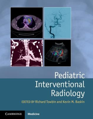 Pediatric Interventional Radiology by Towbin, Richard