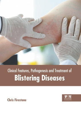 Clinical Features, Pathogenesis and Treatment of Blistering Diseases by Firestone, Chris