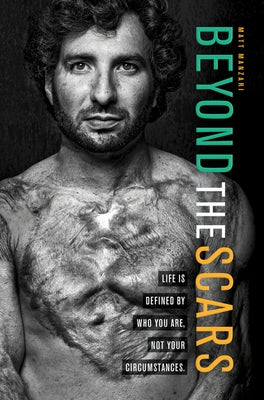 Beyond the Scars: Life Is Defined by Who You Are, Not Your Circumstances Paperback Higherlife Development Service