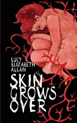 Skin Grows Over by Allan, Lucy Elizabeth