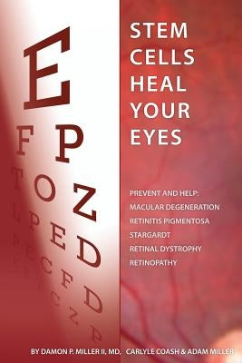 Stem Cells Heal Your Eyes: Prevent and Help: Macular Degeneration, Retinitis Pigmentosa, Stargardt, Retinal Distrophy, and Retinopathy. Paperback Organicmd Media