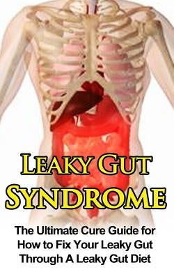 Leaky Gut Syndrome: The Ultimate Cure Guide for How to Fix Your Leaky Gut Through A Leaky Gut Diet by Migan, Wade